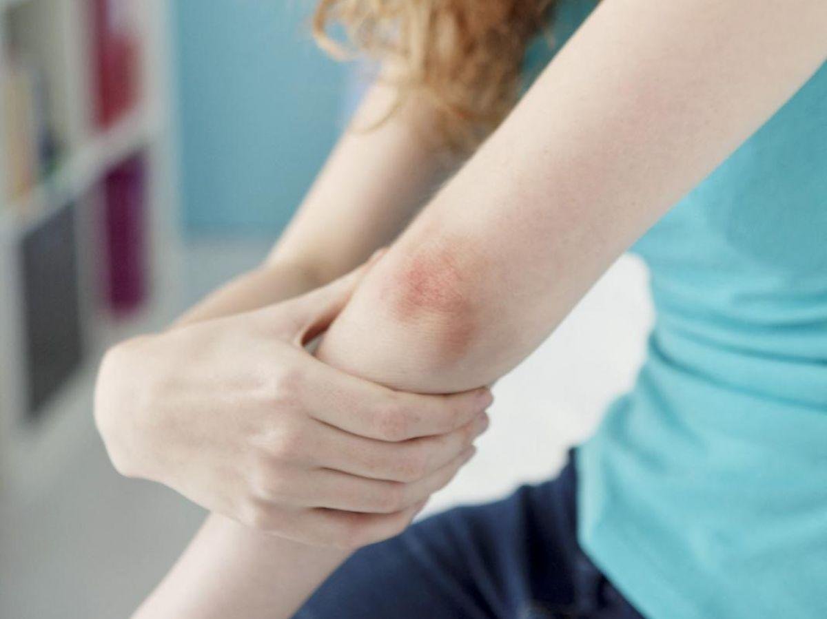 cover-r4x3w1200-68cd110e9fc20-afp-20130604-bsip-013160-026-v1-highres-dermatologyconsultationwoman