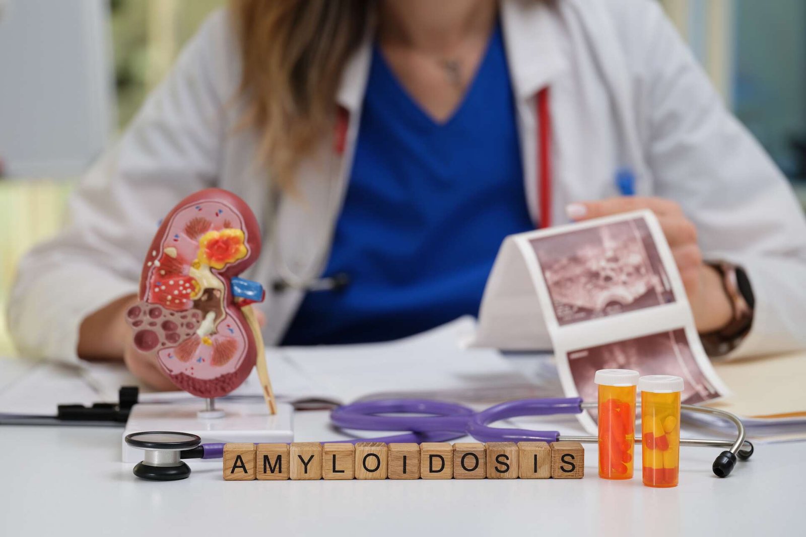 c4d5c51036_50244685_amyloidosis